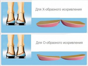 Подпяточники для коррекции Х- и О-образного искривления ног