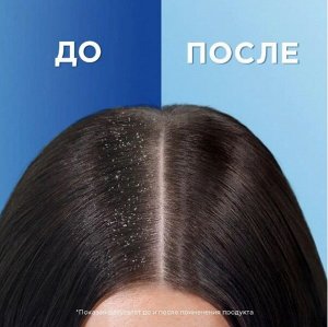 HEAD & SHOULDERS Шампунь и бальзам-ополаскиватель против перхоти 2в1 Основной уход 200мл