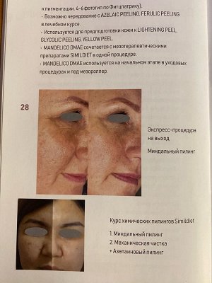 SIMILDIET MANDELICO DMAE (Миндальный пилинг с ДМАЕ 2%)
