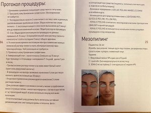 SIMILDIET FERULIC PEELING (Феруловый пилинг)