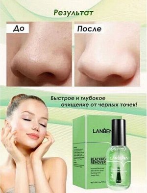 Маска от черных точек Lanbena зеленый флакон с кистью 17мл