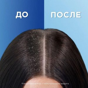 HEAD & SHOULDERS Шампунь против перхоти Объем от самых корней 400мл