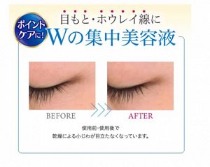 Place Whiter Medicated Whitening Eye Cream - отбеливающая зональная сыворотка