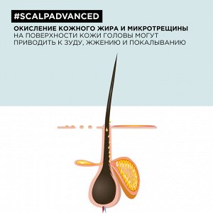 Шампунь для чувствительной кожи головы Loreal Professionel ЛП СЭ Скальп Анти-Дискомф 300 мл EXPS