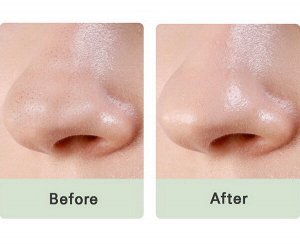 Патчи для очищения носа Mizon Pore Fresh Clear Nose Pack, 1шт