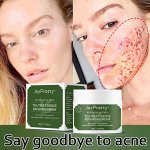 Крем JoyPretty для лечения акне с Чайным Деревом, крем для жирной кожи. 50g