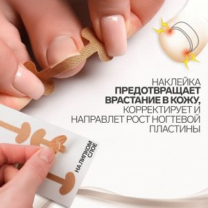 Набор наклеек для коррекции вросших ногтей, 8 шт, 5,2 ? 2 см, цвет бежевый