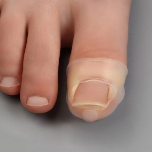 Защитные чехлы от вросших ногтей, пара, 2,8 х 2 см, цвет прозрачный