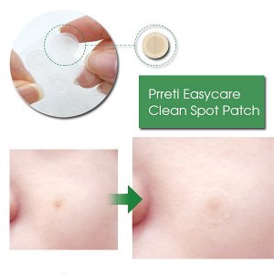 Точечные патчи от прыщей Prreti Easycare Clean Spot Patch, 88шт в 1 уп