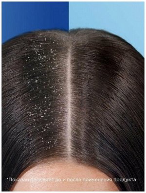 Шампунь Head & Shoulders Основной Уход Шампунь и бальзам-ополаскиватель против перхоти 2 в 1 400 мл