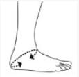 Ортез на голеностопный сустав Orlett со шнуровкой
