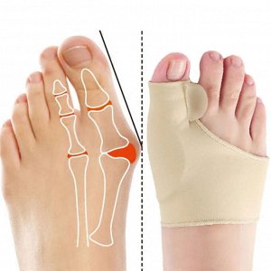 Корректоры для косточки большого пальца ног (пара)