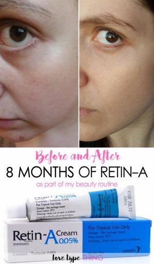 Retin-A Cream 0,05%  VITARA Acnetin-A 0.05% Cream 10G