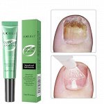 Средство для устранения и профилактики нарушений ногтей Auquest 10ml