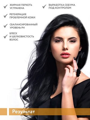 Шампунь против перхоти для жирной кожи головы Oily Dandruff Shampoo, 400 мл