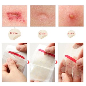 Патчи от прыщей Elizavecca Blemish Spot Patch, 44шт в 1 пачке