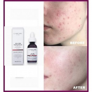 Пилинг-сыворотка Care:nel AHA BHA peeling serum