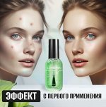 Маска-пилинг для удаления угрей 2 в 1 с экстрактом зеленого
