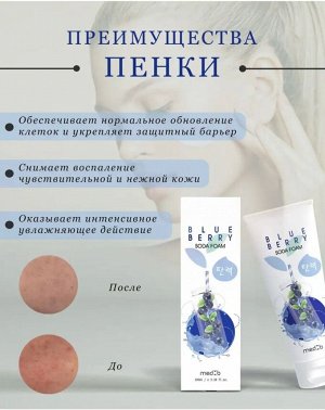 MedB/ Blueberry Soda Foam Пенка для умывания с пищевой содой и черникой 100мл, Корея