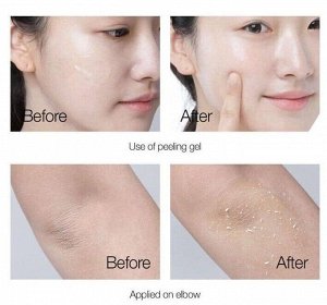PrettySkin Гель-пилинг с экстрактом центеллы Gel Peeling The Pure Jeju Cica, 150 мл