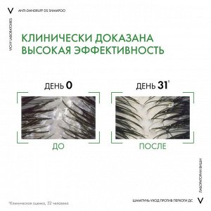 Виши, Шампунь-уход против перхоти для нормальных и жирных волос 75 мл