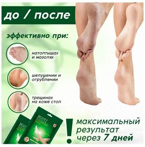 JIGOTT FOOT PACK отшелушивающие носочки 1 пара