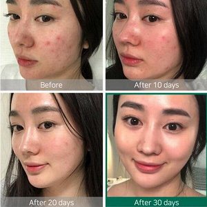 Восстанавливающий крем для проблемной кожи Some By Mi AHA-BHA-PHA 30 Days Miracle Cream, 60г