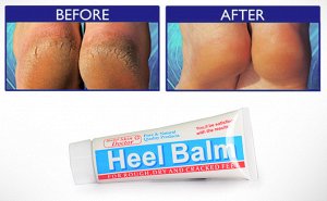 Крем heel balm для лечения трещин на пятках