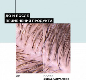 Шампунь 2 в 1 и маска для жирной кожи головы Loreal Scalp Advanced 250 мл Лореаль