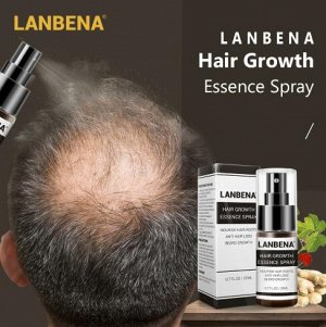 Спрей от выпадения волос LANBENA