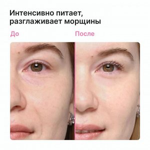 Ночной питательный крем для лица с мочевиной 15% EpilProfi 250 мл