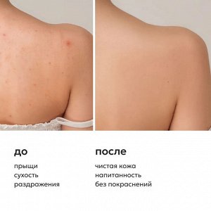 Ликато Гель для душа успокаивающий против несовершенств кожи Likato NO ACNE SKIN 250 мл