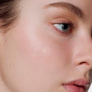 Some By Mi Micro Pin Spot Patch Патчи от прыщей с микроиглами