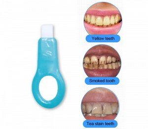 Средство для отбеливания зубов TEETH CLEANING KIT