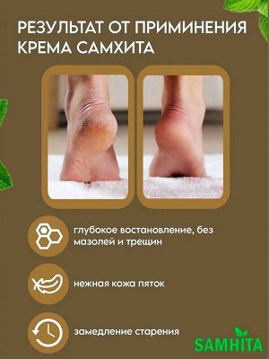 Крем для пяток Аювердический Самхита быстрого действия 25г пр-во Индия