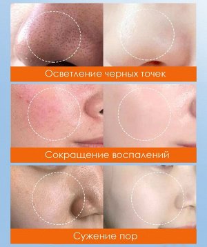 Пузырьковая маска для лица с экстрактом моркови Sadoer, 85 гр.