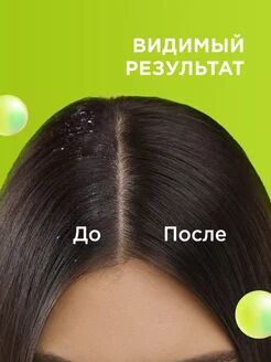 Шампунь и бальзам - ополаскиватель 2 в 1 против перхоти MYMUSE 400мл