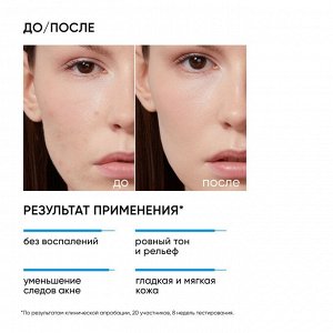 Айкон Скин Пилинг для проблемной кожи 18%, 30 мл (Icon Skin, Re:Program)
