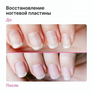 EpilProfi SOS - сыворотка для ногтей и кутикулы от пропилов и ломкости 10 мл