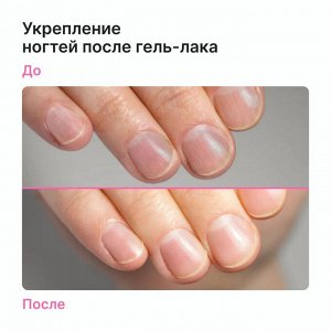 EpilProfi SOS - сыворотка для ногтей и кутикулы от пропилов и ломкости 10 мл