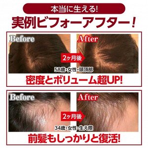 Pelo Rico Hair Revitalizing Solution - лосьон для роста волос