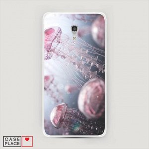 Силиконовый чехол Медузы на Alcatel Pixi 4 (5) 5045D