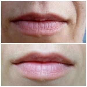 Сыворотка «VOLUME LIPS & ЭФФЕКТ 3D» ДЛЯ ГУБ