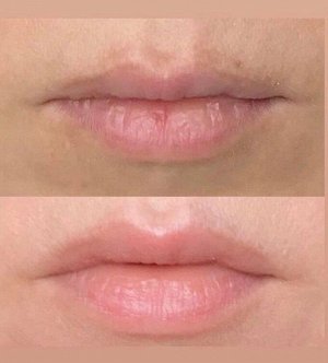 Сыворотка «VOLUME LIPS & ЭФФЕКТ 3D» ДЛЯ ГУБ