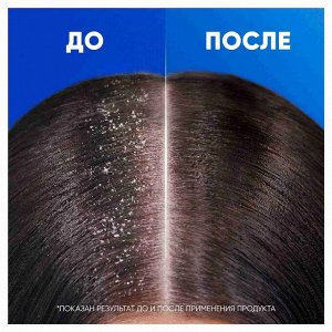 HEAD & SHOULDERS Шампунь для волос от перхоти Яблочная свежесть 600мл