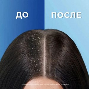 ХЕД & ШОЛДЕРС Шампунь "Глубокое Увлажнение" 400 мл