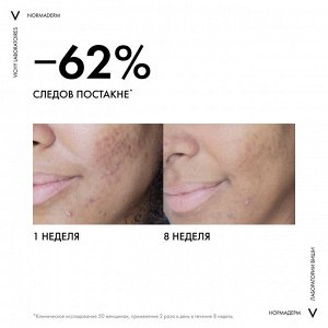 Виши Корректирующий флюид двойного действия для проблемной кожи Phytosolution, 50 мл (Vichy, Normaderm)