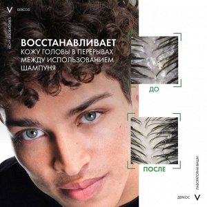 Виши Интенсивная сыворотка от перхоти для волос и кожи головы Anti-Dandruff Serum 10, 90 мл (Vichy, Dercos)