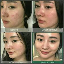 Набор миниатюр для проблемной кожи с кислотами Some By Mi Aha-Bha-Pha 30 Days Miracle Starter 4 Kit, 30гр + 30мл + 10мл + 20гр