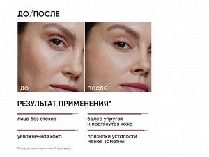 ICON SKIN SMART ЛИМФОДРЕНАЖ Тоник лимфодренажный Skin Gym